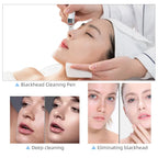 Missheart Professional Beauty Facial Machine  Hydra Aqua Deep Cleaning Skin Care Device（ EU /UK /US Fast Shipping）