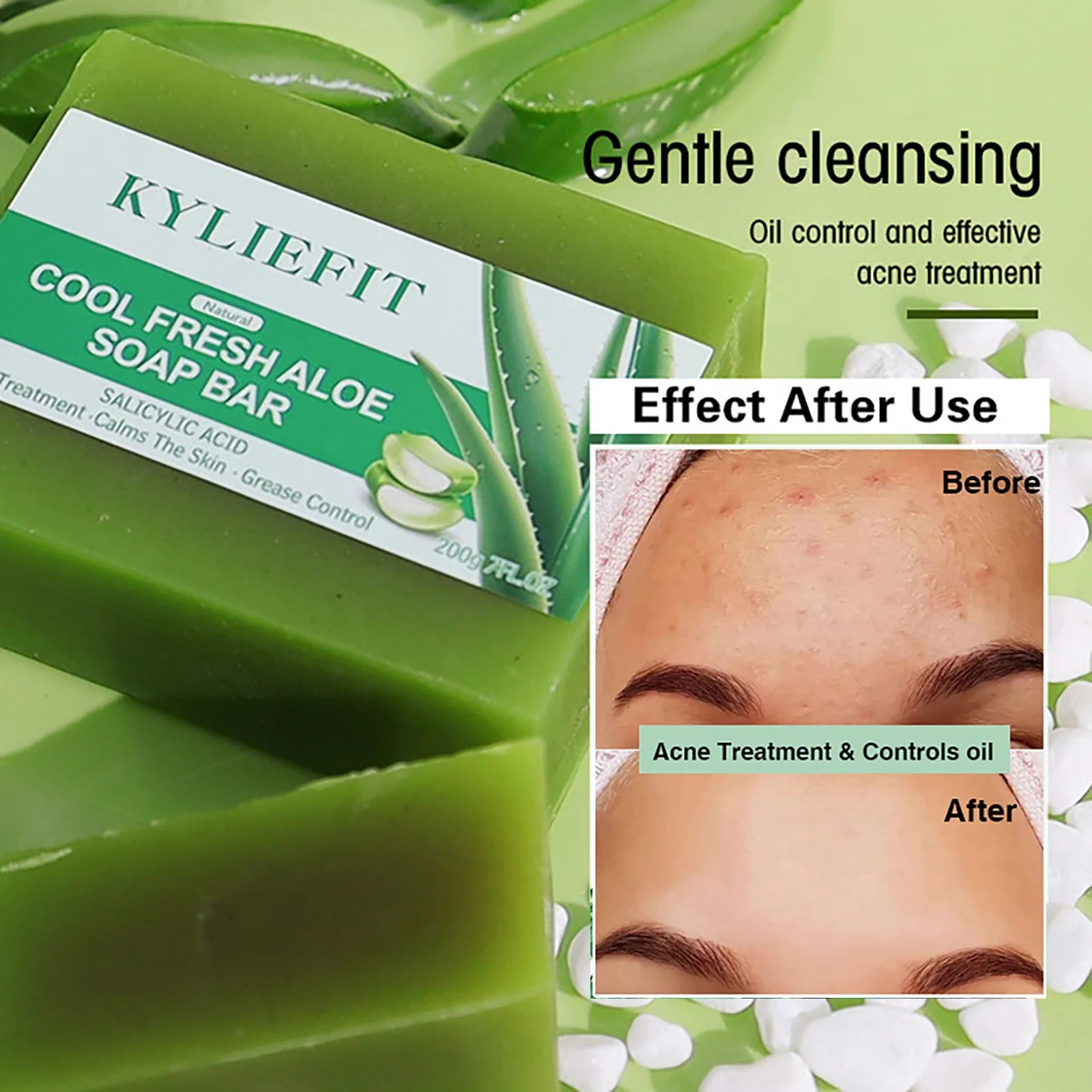 AILKE Aloe Vera Whitening Soap, Remove Acne, Spots, Skin Radiant, Improve Skin Luster, Vegan Bath Wash for All Skin Types, 200g Main image