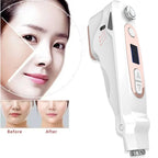 Professional Mini HIFU Facial Rejuvenation Anti Aging Wrinkle Beauty Machine Ultrasonic Skin Care SPA Salon Home Use For Women