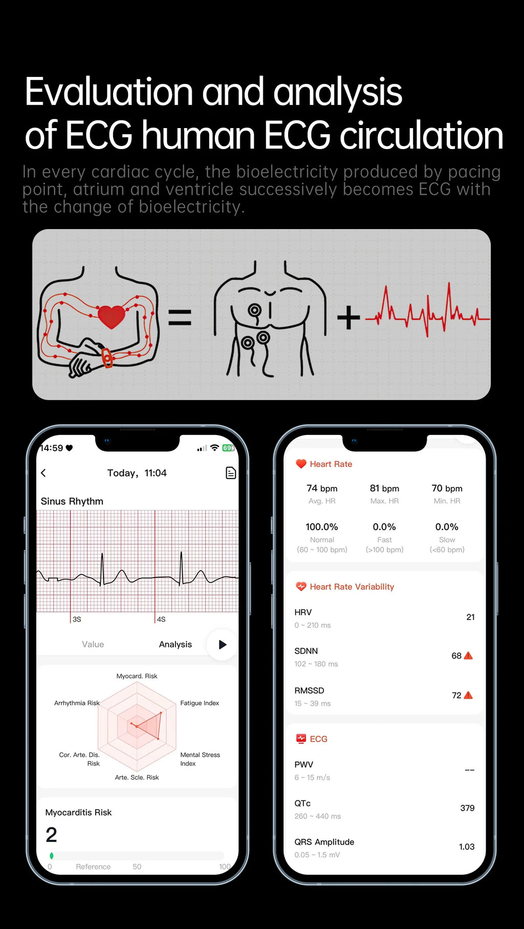 2026 New Nursing Grade ECG+PPG Smart Watch Health Analysis Blood pressure Lipids Uric acid Wireless HD Call Smartwatch Men Women