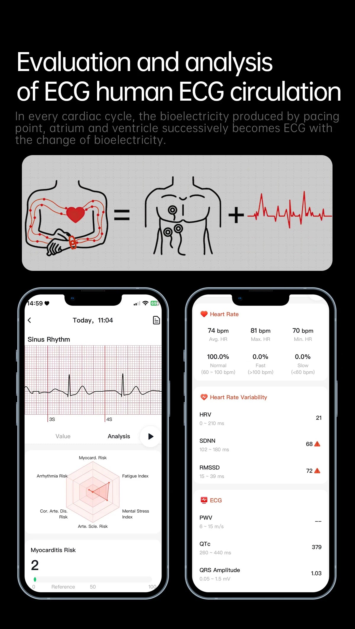 2026 New Nursing Grade ECG+PPG Smart Watch Health Analysis Blood pressure Lipids Uric acid Wireless HD Call Smartwatch Men Women