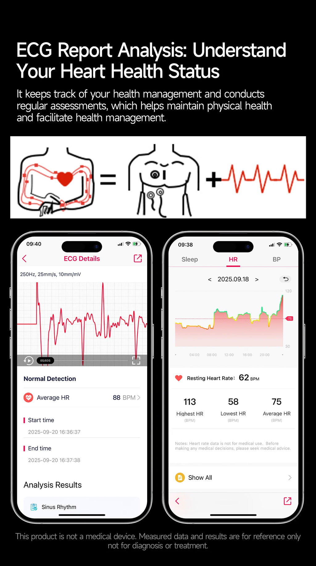 New Accurate ECG Smart Watch Blood Lipids Five Viscera Health Check Body Temperature BT Call Sports Smart Watches For Men 2026