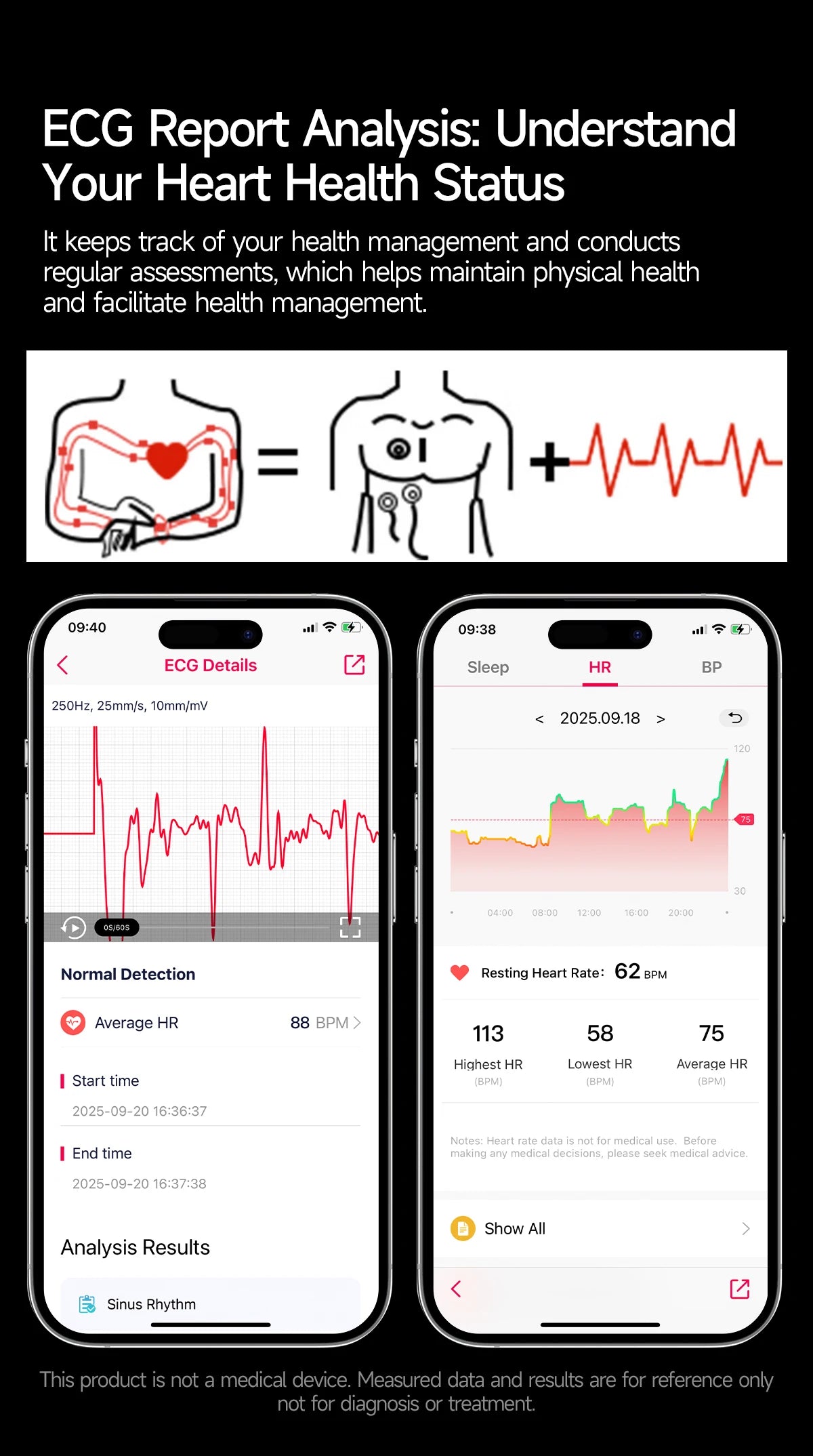 New Accurate ECG Smart Watch Blood Lipids Five Viscera Health Check Body Temperature BT Call Sports Smart Watches For Men 2026